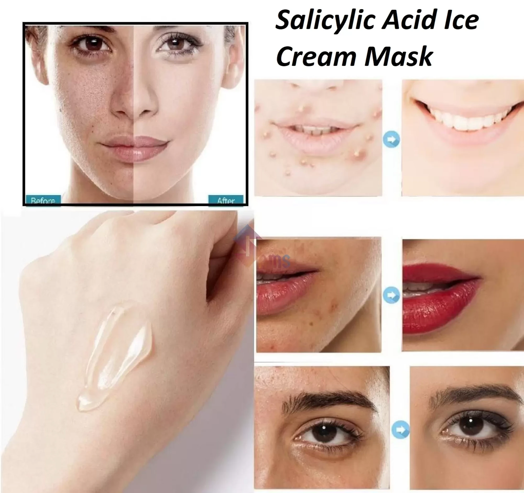 Salicylic Acid Mask 3.webp